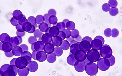 Čo je MRSA a&nbsp;ako sa zbaviť zlatého stafylokoka