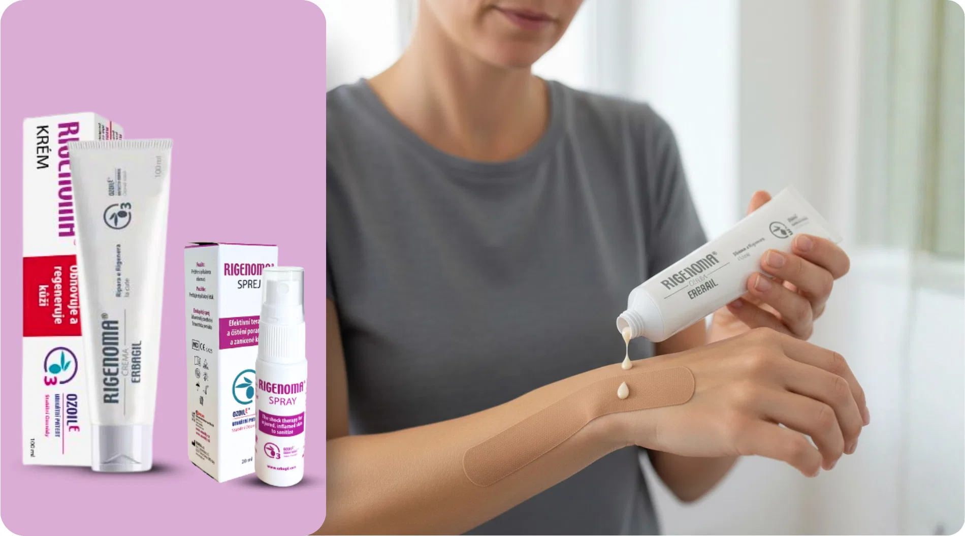 Príklad opätovnej aktivácie tejpovacej pásky