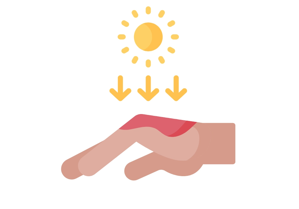 Spálená kůže od slunce je popálenina 1. stupně. Pomozte si při hojení s ActiMaris.