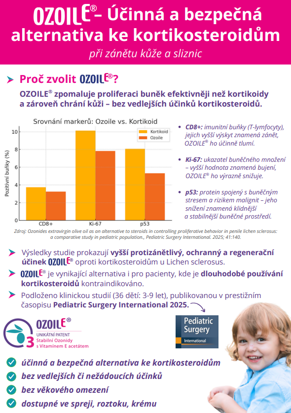 studie-ozoile-vs-kortikosteroidy studie-ozoile-vs-kortikosteroidy